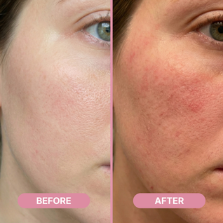 Rejula PDRN Pink One Day Serum