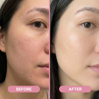 Rejula PDRN Pink One Day Serum