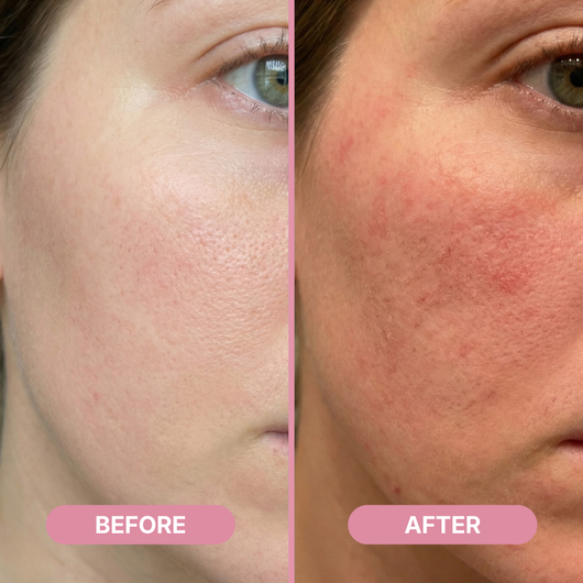 Rejula Hyaluronic PDRN Orb Serum