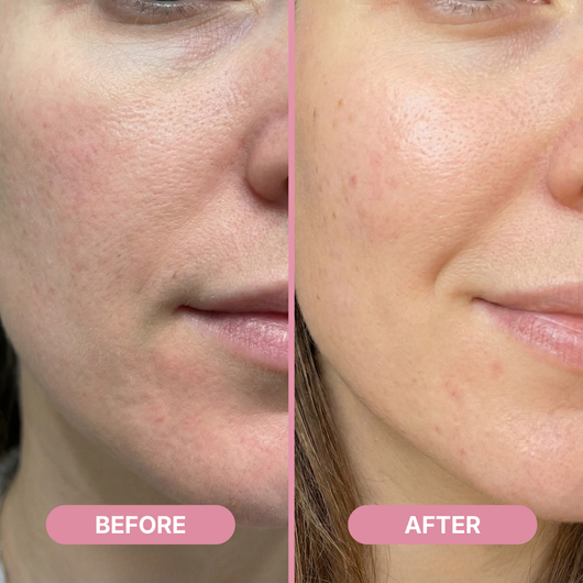 Rejula Hyaluronic PDRN Orb Serum