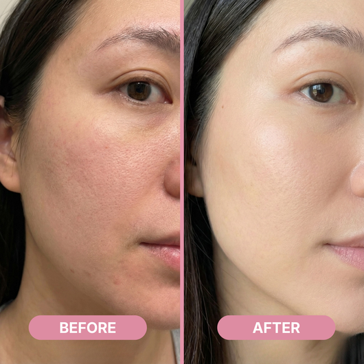 Rejula Hyaluronic PDRN Orb Serum