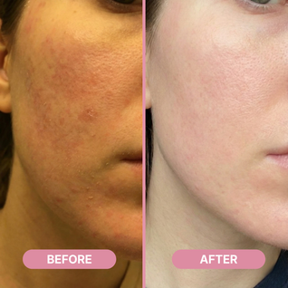 Rejula Hyaluronic PDRN Orb Serum