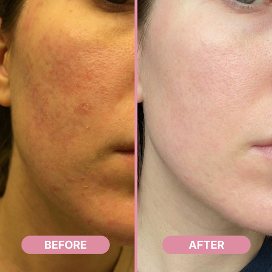 Rejula Hyaluronic PDRN Orb Serum